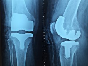 Kiedy warto udać się do kliniki ortopedycznej?