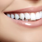 Licówki porcelanowe w Szczecinie