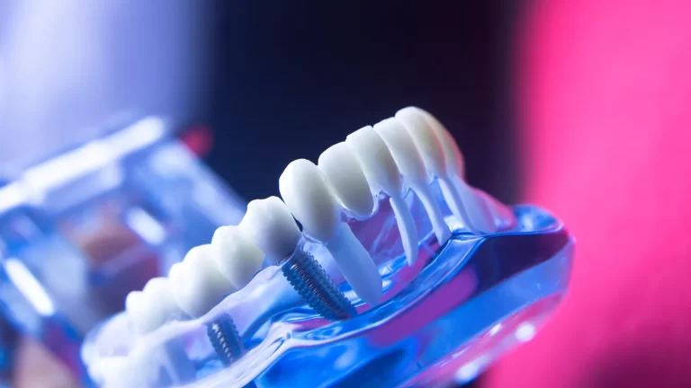 Implanty zębów Lublin