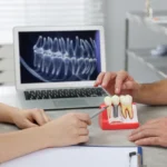 Jakie są objawy odrzucenia implantu zębowego