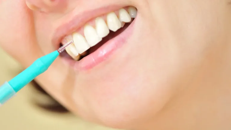 Protetyka stomatologiczna zębów Szczecin