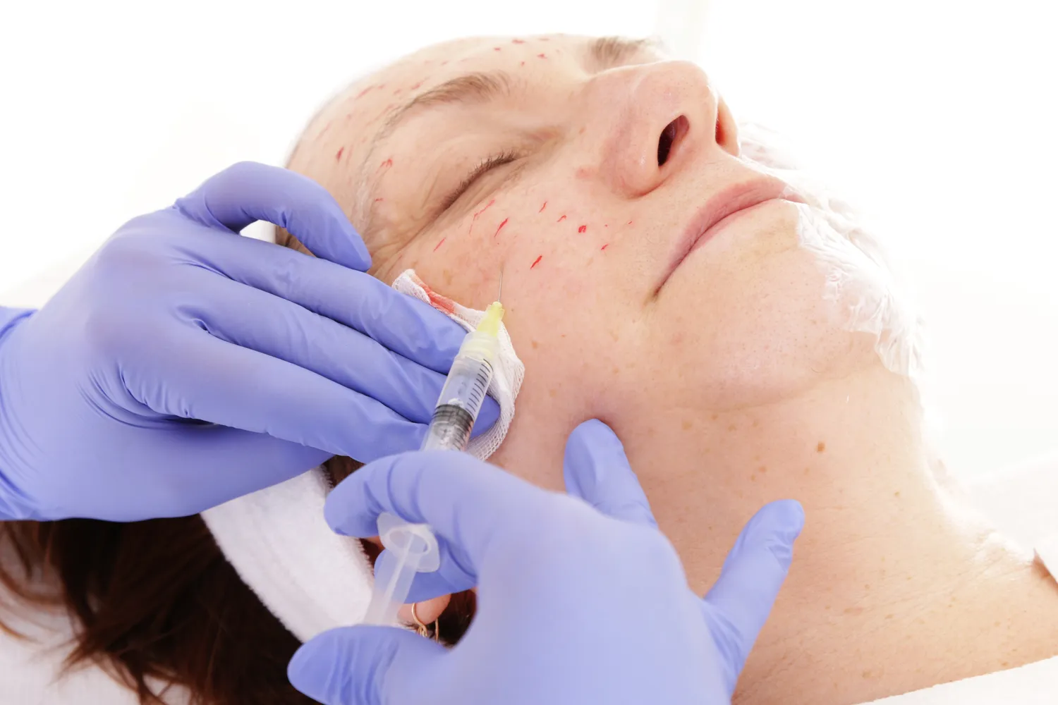 Medycyna estetyczna gdzie?