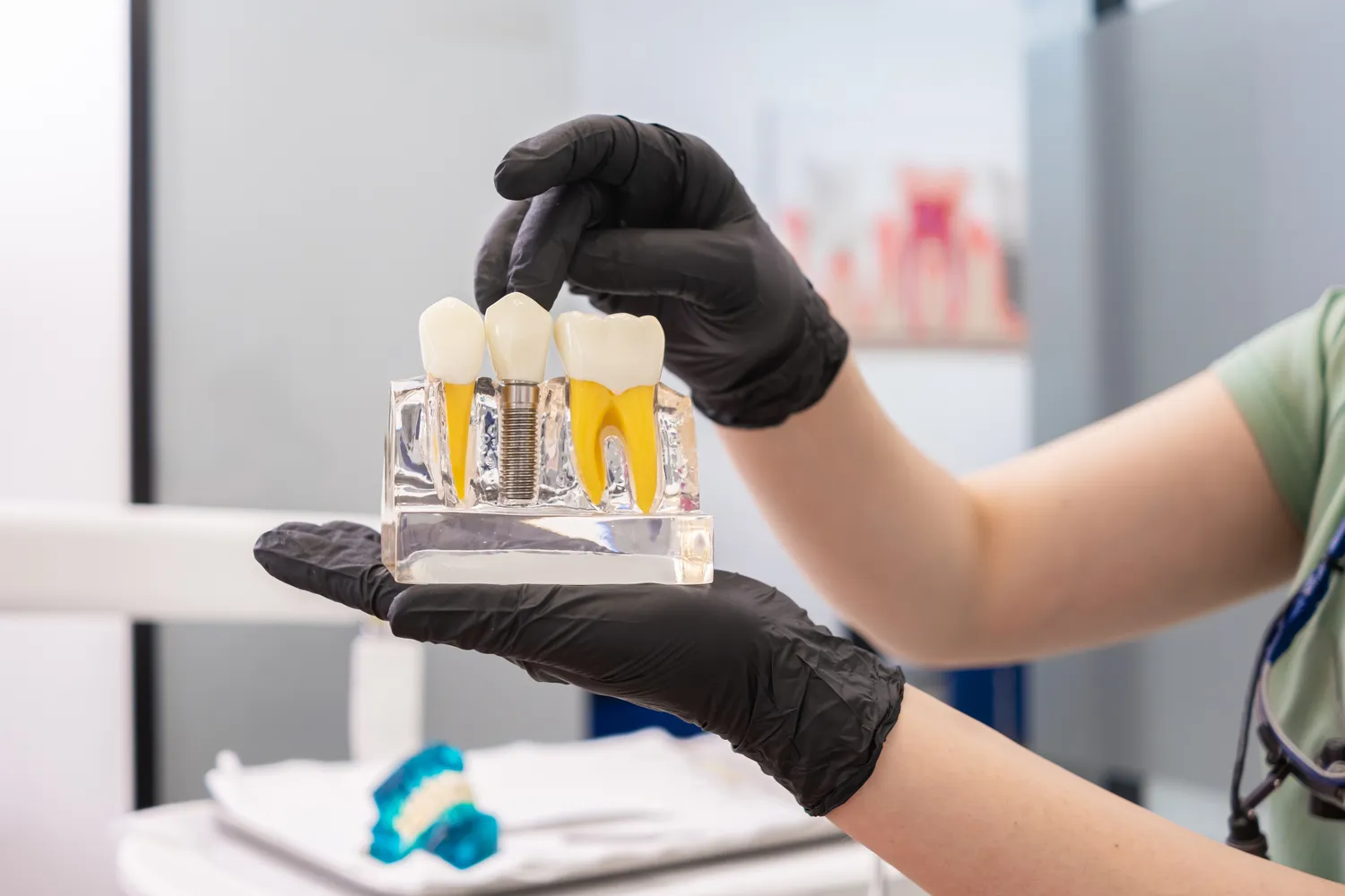 Leczenie kanałowe pod mikroskopem Szczecin