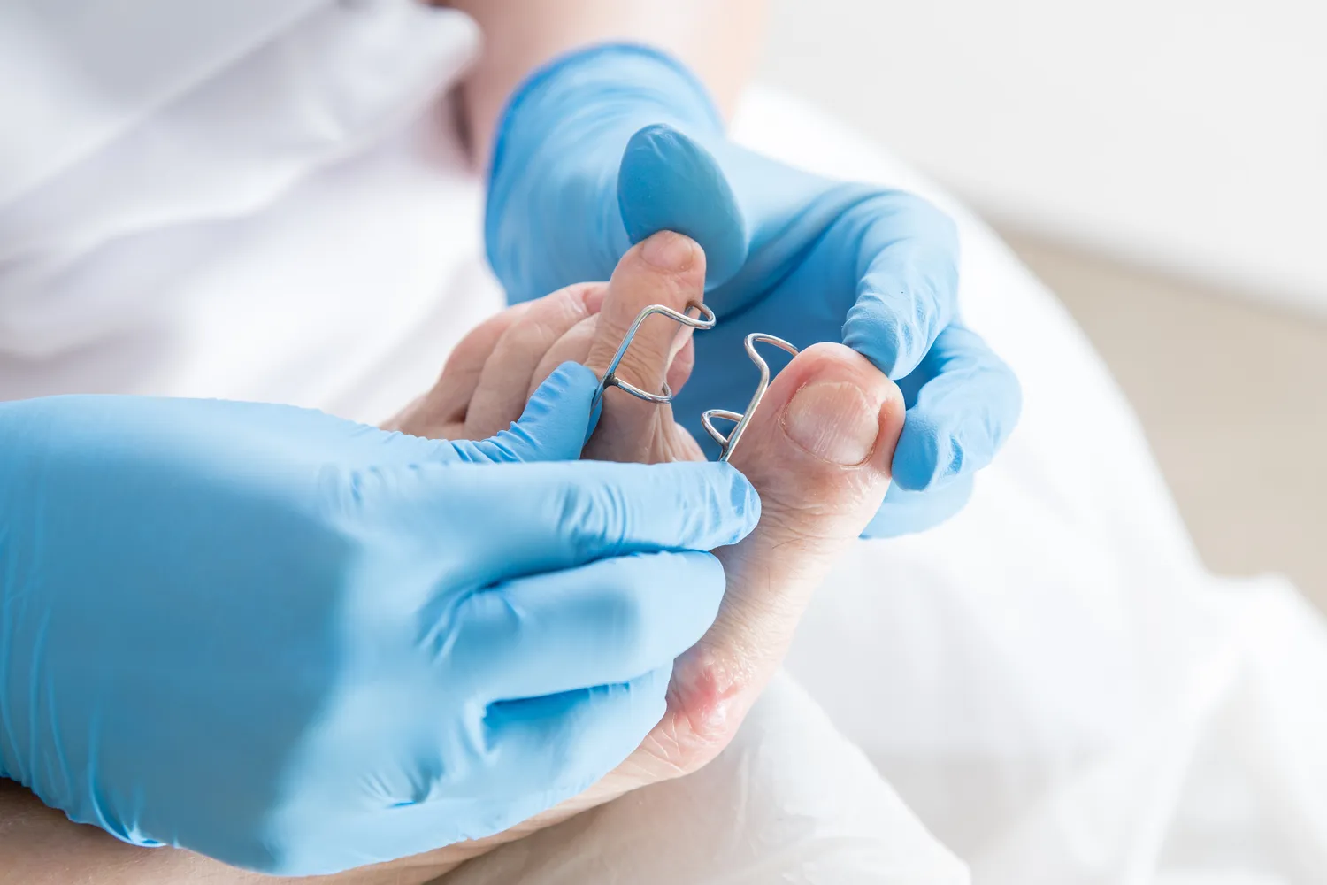 Leczymy stopy, czyli wizyta u podologa